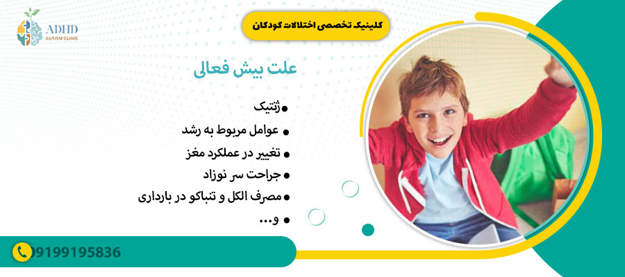 علت بیش فعالی